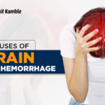 Brain Hemorrhage