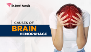 Brain Hemorrhage