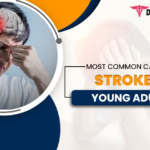 common-cause-of-stroke