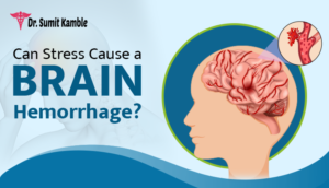 Can Stress Cause a Brain Hemorrhage