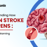 How Brain Stroke Happens