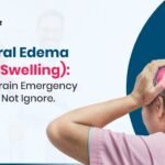 Cerebral Edema (Brain Swelling)