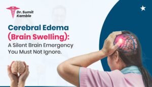 Cerebral Edema (Brain Swelling)