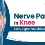 Nerve Pain in Knee