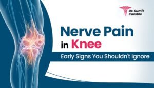 Nerve Pain in Knee