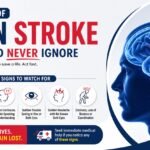 Brain stroke