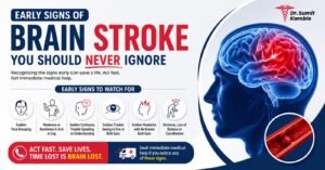Brain stroke