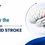 Neurologist in jaipur